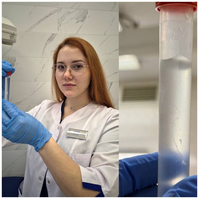  Редкий случай в Омске: врачи извлекли паразита из глаза пациентки